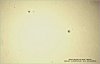 Eric HAZEBROUCQ - Taches solaires